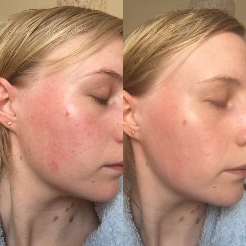 Пилинг для лица с молочной кислотой и витамином B3 Bravura London Glycolic Acid 10% Peel with Vitamin B5 30ml