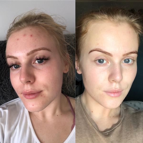 Пилинг с 10% гликолевой кислотой Bravura London Glycolic Acid 10% Peel with Vitamin B5 Бравура 30 ml