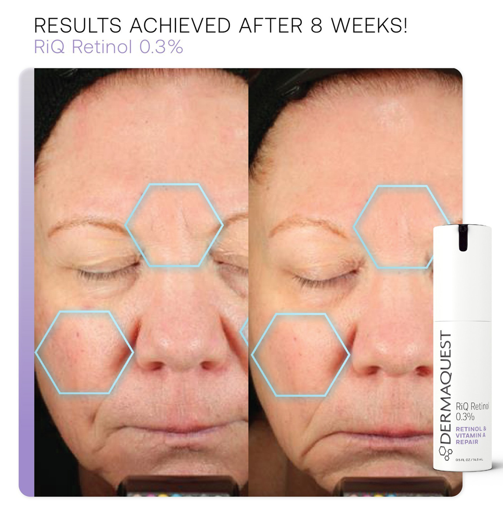 Cыворотка для омоложения и коррекции пигментации с ретинолом 0.3% Dermaquest RiQ Retinol 0.3% 29.6ml