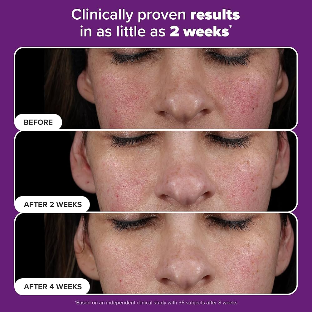 Сыворотка с ретинальдегидом Paula’s Choice Pro-Clinical Retinaldehyde Dual-Retinoid Treatment 30ml