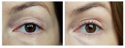 Сыворотка для глаз с витамином C iS Clinical C Eye Serum Advance 15ml